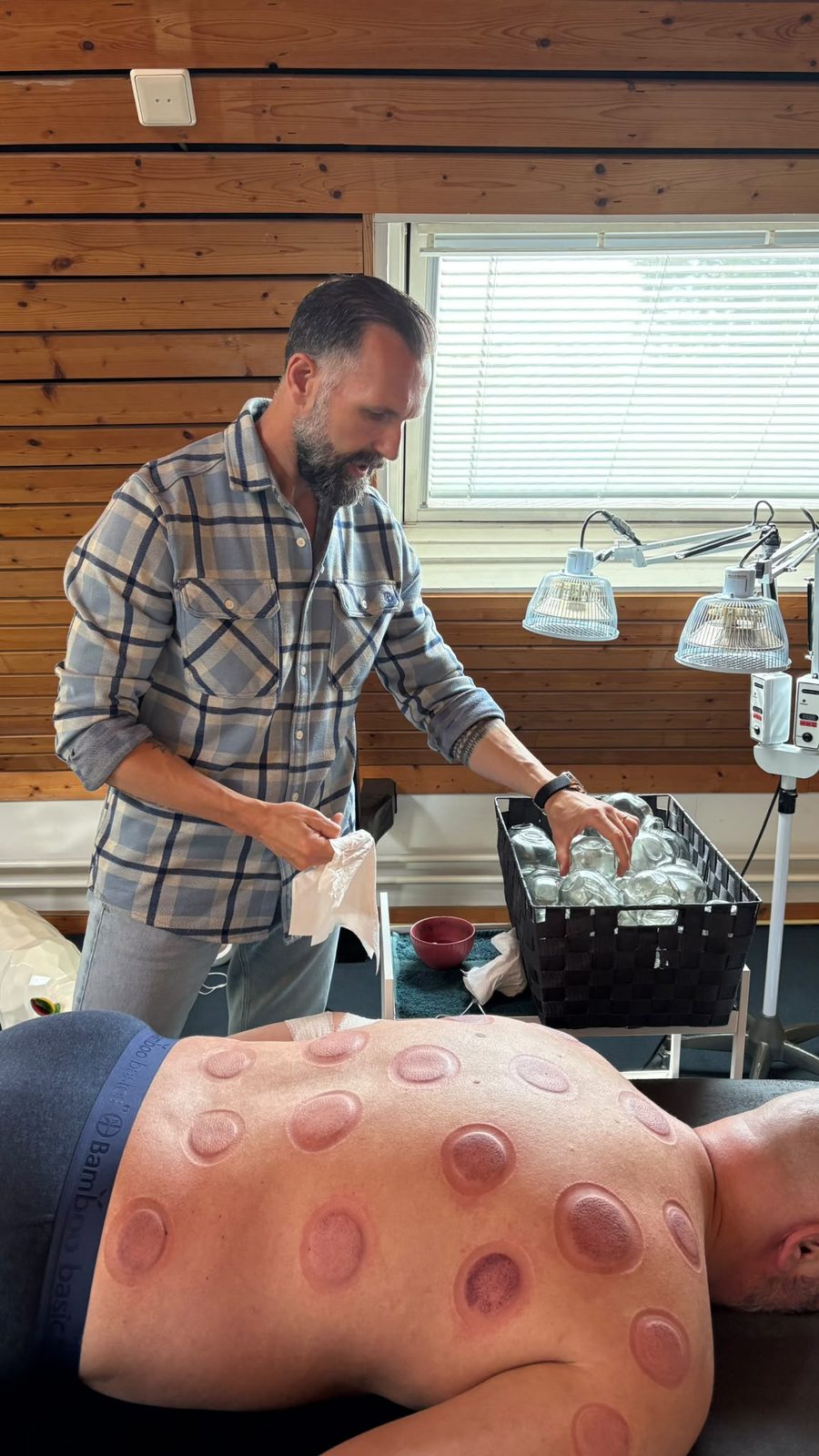 Vuurcupping